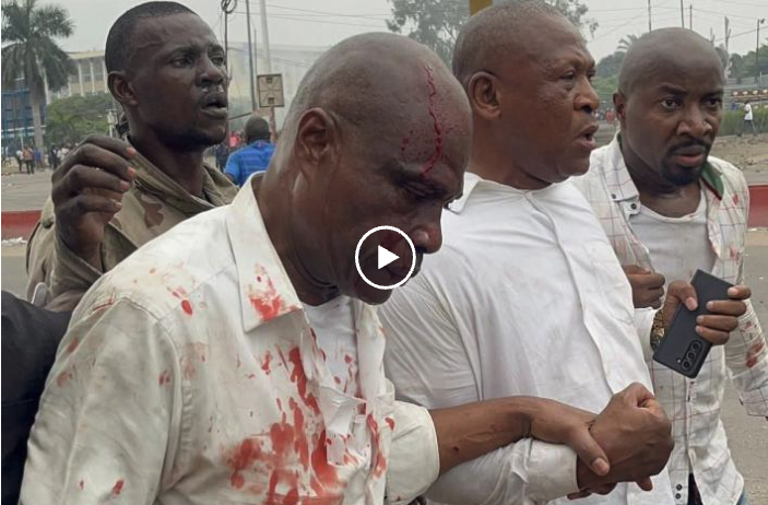 Marche de l’opposition à Kinshasa : heurts violents aux abords du Palais du Peuple, Martin Fayulu grièvement blessé Marche de l’opposition à Kinshasa : heurts violents aux abords du Palais du Peuple, Martin Fayulu grièvement blessé